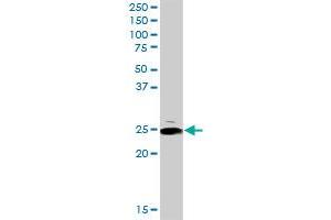 ARHGDIA MaxPab rabbit polyclonal antibody. (ARHGDIA 抗体  (AA 1-204))