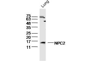 Mouse Lung lysates probed with NPC2 Polyclonal Antibody, Unconjugated  at 1:300 dilution and 4˚C overnight incubation. (NPC2 抗体  (AA 20-80))