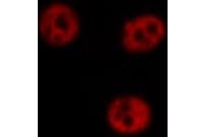 ABIN6266711 staining Hela by IF/ICC. (AKAP8 抗体  (Internal Region))
