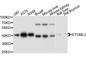 Western blot analysis of extracts of various cell lines, using STOML2 antibody. (STOML2 抗体)