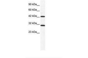 Image no. 1 for anti-DEAD (Asp-Glu-Ala-Asp) Box Polypeptide 39A (DDX39) (N-Term) antibody (ABIN203128) (DDX39 抗体  (N-Term))