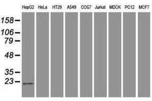Image no. 2 for anti-Adenylate Kinase 1 (AK1) antibody (ABIN1496517) (Adenylate Kinase 1 抗体)