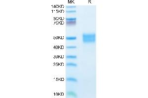 Human IGFBP-3 on Tris-Bis PAGE under reduced condition. (IGFBP3 Protein (AA 28-291) (His tag))
