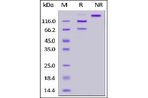 SDS-PAGE (SDS) image for Complement Component 5 (C5) (AA 19-1676) (Active) protein (His tag) (ABIN6938883)