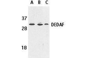 Western Blotting (WB) image for anti-RING1 and YY1 Binding Protein (RYBP) (AA 215-228) antibody (ABIN2473292) (RYBP 抗体  (AA 215-228))