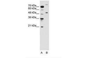 Image no. 1 for anti-Tripartite Motif Containing 42 (TRIM42) (AA 601-650) antibody (ABIN6736653) (TRIM42 抗体  (AA 601-650))