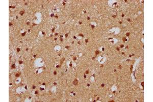 IHC image of ABIN7165594 diluted at 1:300 and staining in paraffin-embedded human brain tissue performed on a Leica BondTM system. (FEV 抗体  (AA 1-97))