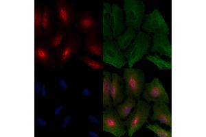 ABIN6266068 and ABIN6266678 staining  cells by IF/ICC.