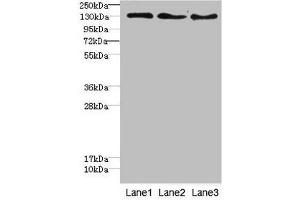 Western blot All lanes: RBP2antibody at 1. (RBP2 抗体  (AA 1-134))