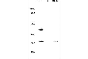 Lane 1: mouse testis lysates Lane 2: mouse brain lysates probed with Anti RSPO1 Polyclonal Antibody, Unconjugated (ABIN715451) at 1:200 in 4 °C. (RSPO1 抗体)