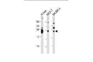 All lanes : Anti-GSTM4 Antibody (N-term) at 1:2000 dilution Lane 1: Human liver tissue lysate Lane 2: MCF-7 whole cell lysate Lane 3: SK-BR-3 whole cell lysate Lysates/proteins at 20 μg per lane. (GSTM4 抗体  (N-Term))