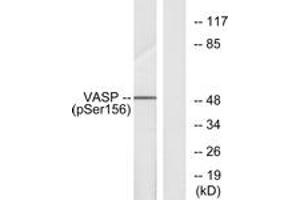 Western blot analysis of extracts from NIH-3T3 cells treated with forskolin 40 muM 30', using VASP (Phospho-Ser157) Antibody. (VASP 抗体  (pSer157))