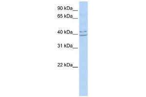 PYHIN1 antibody used at 0. (PYHIN1 抗体  (N-Term))