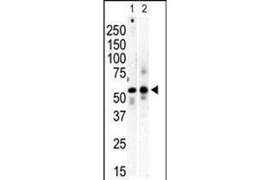 Western Blotting (WB) image for anti-Phosphatidylinositol 4-Kinase Type 2 beta (PI4K2B) (AA 305-336), (C-Term) antibody (ABIN5532966)