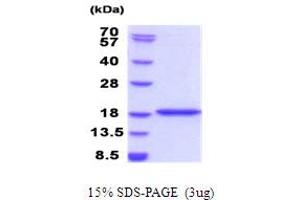 SDS-PAGE (SDS) image for Bromodomain Containing 1 (BRD1) (AA 556-688) protein (His tag) (ABIN5853949)