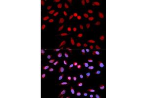 Immunofluorescence analysis of U2OS cells using PPP1CA antibody. (PPP1CA 抗体)