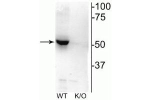 Western blot of mouse habenula lysate showing specific immunolabeling of the ~52 kDa nAChRβ2 protein. (CHRNB2 抗体  (Cytoplasmic Loop))