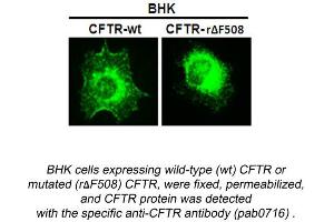 Image no. 1 for anti-Cystic Fibrosis Transmembrane Conductance Regulator (ATP-Binding Cassette Sub-Family C, Member 7) (CFTR) (N-Term) antibody (ABIN559718) (CFTR 抗体  (N-Term))