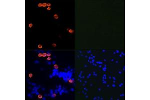 Immunofluorescence analysis of 293T cells transfected with SARS-Cov-2 3CLpro and untreated 293T cells using SARS-CoV-2 3CLpro Rabbit mAb (ABIN7270150) at dilution of 1:100/1:400/1:800(40x lens). (SARS-Coronavirus Nonstructural Protein 8 (SARS-CoV NSP8) 抗体)