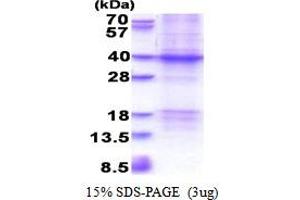 XRCC2 Protein (AA 1-280) (His tag)