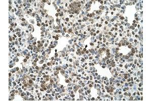 OSBPL9 antibody was used for immunohistochemistry at a concentration of 4-8 ug/ml to stain Alveolar cells (arrows) in Human Lung. (OSBPL9 抗体  (N-Term))