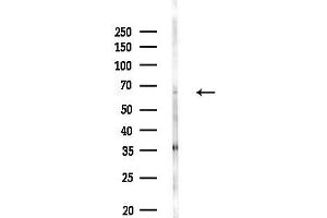 Western blot analysis of lysates from MDA-MB-231 cells(heat-shock,45 min treatment), using RB Antibody at 1/1000 dilution.