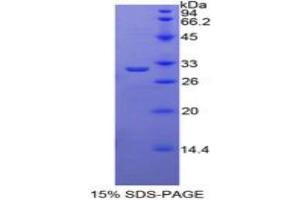SDS-PAGE analysis of Mouse TRADD Protein. (TRADD 蛋白)