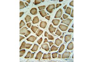 FIBG Antibody (C-term) (ABIN390507 and ABIN2840862) IHC analysis in formalin fixed and paraffin embedded human skeletal muscle tissue followed by peroxidase conjugation of the secondary antibody and DAB staining. (FGG 抗体  (C-Term))