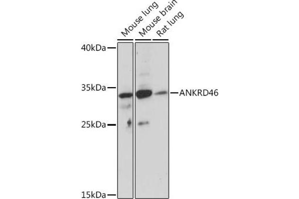 ANKRD46 抗体