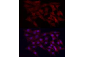 Immunofluorescence analysis of NIH/3T3 cells using WDR45 Rabbit pAb (ABIN6133064, ABIN6150194, ABIN6150195 and ABIN6223490) at dilution of 1:100 (40x lens). (WDR45 抗体  (AA 1-360))