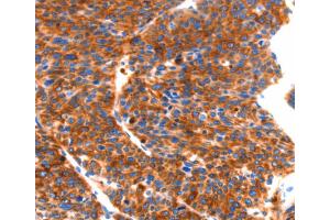 Immunohistochemistry (IHC) image for anti-Septin 4 (SEPT4) antibody (ABIN2432616) (Septin 4 抗体)