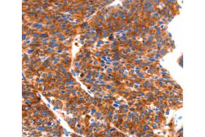 Immunohistochemistry (IHC) image for anti-Septin 4 (SEPT4) antibody (ABIN2432617) (Septin 4 抗体)