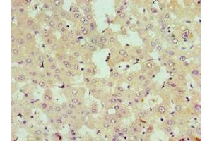 Immunohistochemistry of paraffin-embedded human liver tissue using ABIN7168990 at dilution of 1:100 (STK3 抗体  (AA 323-450))