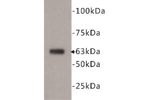 Western Blotting (WB) image for anti-5'-Nucleotidase, Ecto (CD73) (NT5E) antibody (ABIN1854862) (CD73 抗体)
