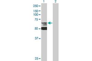 Western Blot analysis of LBR expression in transfected 293T cell line by LBR MaxPab polyclonal antibody. (Lamin B Receptor 抗体  (AA 1-615))