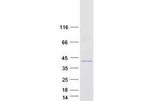 Western Blotting (WB) image for ATPase, Aminophospholipid Transporter, Class I, Type 8B, Member 2 (ATP8B2) (Transcript Variant 2) protein (Myc-DYKDDDDK Tag) (ABIN2715067)