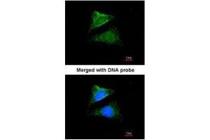 ICC/IF Image Immunofluorescence analysis of paraformaldehyde-fixed HeLa, using Seladin 1, antibody at 1:200 dilution. (Seladin 1 抗体)