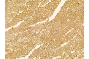 CDK5RAP1 Mouse Monoclonal Antibody at 1/100 staining rat heart tissue by IHC-P. (CDK5RAP1 抗体  (C-Term))