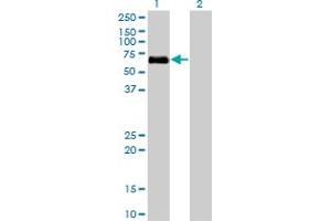 Western Blot analysis of BMPR1A expression in transfected 293T cell line by BMPR1A monoclonal antibody (M01), clone 4C4. (BMPR1A 抗体  (AA 1-532))