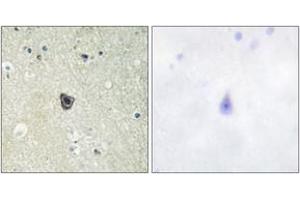 Immunohistochemistry analysis of paraffin-embedded human brain tissue, using CSFR (Ab-809) Antibody. (CSF1R 抗体  (AA 781-830))