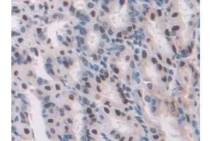 Immunohistochemistry (IHC) image for anti-Transaldolase 1 (TALDO1) (AA 35-285) antibody (ABIN7440293)