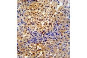 Immunohistochemistry (Paraffin-embedded Sections) (IHC (p)) image for anti-PRP38 Pre-mRNA Processing Factor 38 (Yeast) Domain Containing A (PRPF38A) (AA 283-312), (C-Term) antibody (ABIN954326)