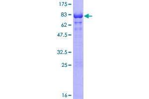 Image no. 1 for Telomeric Repeat Binding Factor 2, Interacting Protein (TERF2IP) (AA 1-399) protein (GST tag) (ABIN1322481) (RAP1 Protein (AA 1-399) (GST tag))