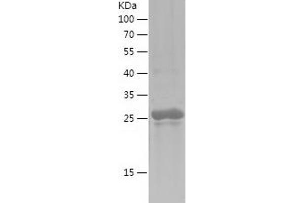 TFAP2A Protein (AA 213-437) (His tag)