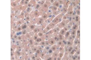 Used in DAB staining on fromalin fixed paraffin- embedded Kidney tissue (TSC22D3 抗体  (AA 1-137))