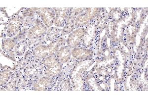 Detection of DTYMK in Porcine Kidney Tissue using Monoclonal Antibody to Deoxythymidylate Kinase (DTYMK) (DTYMK 抗体  (AA 43-190))