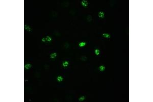 Immunofluorescence staining of A549 cells(treated with 100 ng/mL EGF for 20 min) with ABIN7127690 at 1:100,counter-stained with DAPI. (Recombinant EIF2S1 抗体  (pSer51))