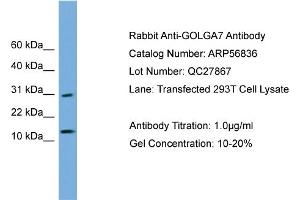 WB Suggested Anti-GOLGA7  Antibody Titration: 0. (Golgin A7 抗体  (N-Term))