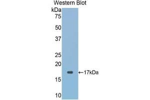 Western blot analysis of the recombinant protein. (GLRX3 抗体  (AA 144-234))
