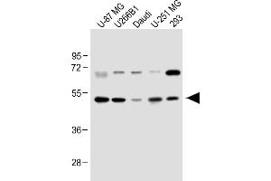 All lanes : Anti-WDR41 Antibody (C-term) at 1:1000 dilution Lane 1: U-87 MG whole cell lysate Lane 2: U266B1 whole cell lysate Lane 3: Daudi whole cell lysate Lane 4: U-251 MG whole cell lysate Lane 5: 293 whole cell lysate Lysates/proteins at 20 μg per lane. (WDR41 抗体  (C-Term))